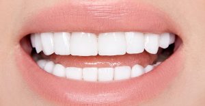 How do teeth whiteners work