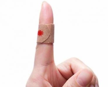 Why do paper cuts hurt so much